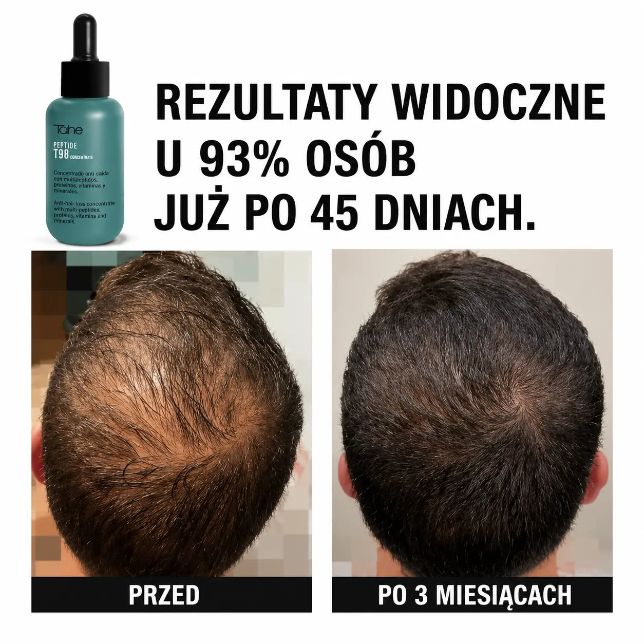 Tahe Peptide T98 koncentrat przeciw wypadaniu włosów