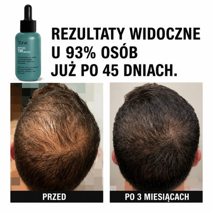 Tahe Peptide T98 koncentrat przeciw wypadaniu włosów
