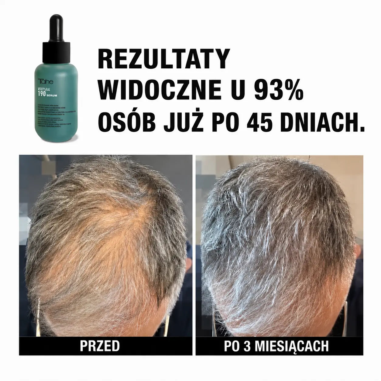 Tahe Peptide T98 koncentrat przeciw wypadaniu włosów