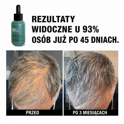 Tahe Peptide T98 koncentrat przeciw wypadaniu włosów